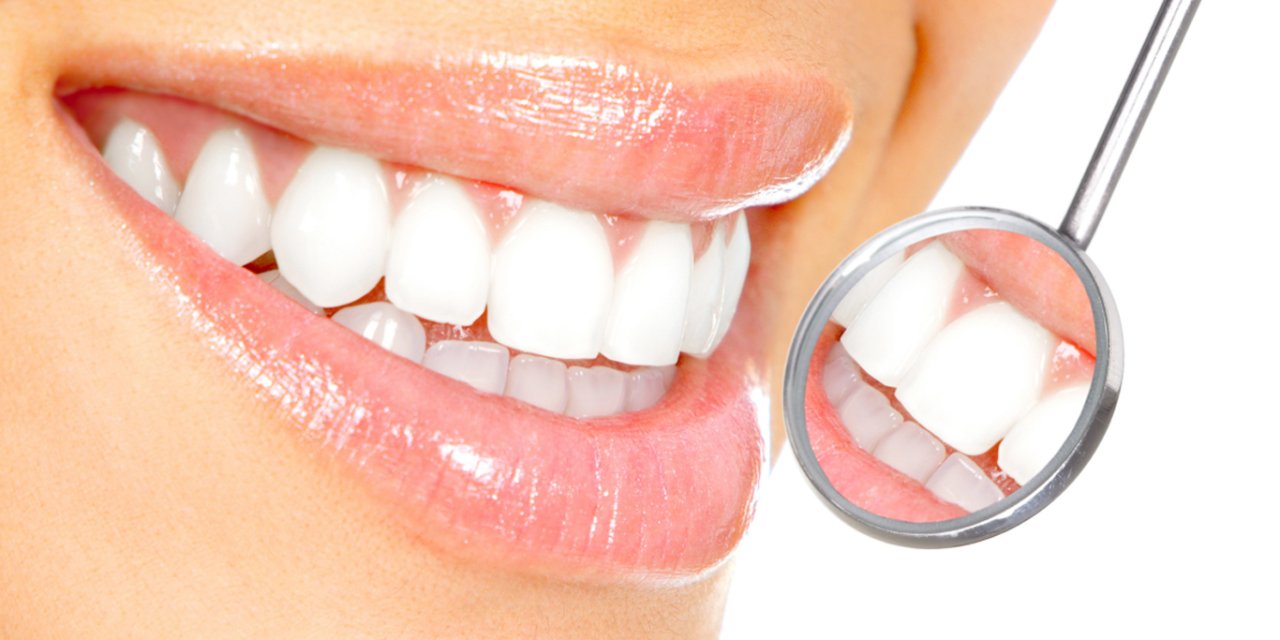Bembeyaz dişler için paranızı boşa harcamayın! Evde diş beyazlatma yöntemleri… Dişleriniz tek seferde ışıl ışıl olacak